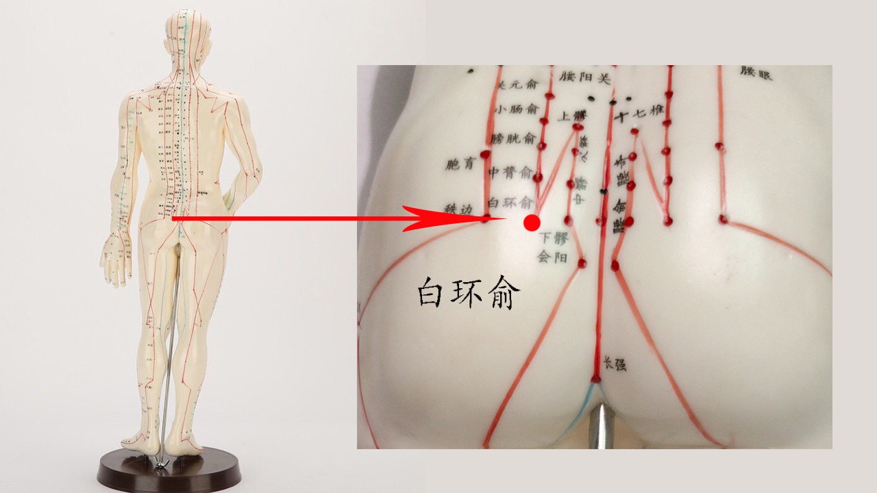 让病人平趴着,取腰俞,大肠俞,白环俞;或腰骶部阳性点,进行局部常规