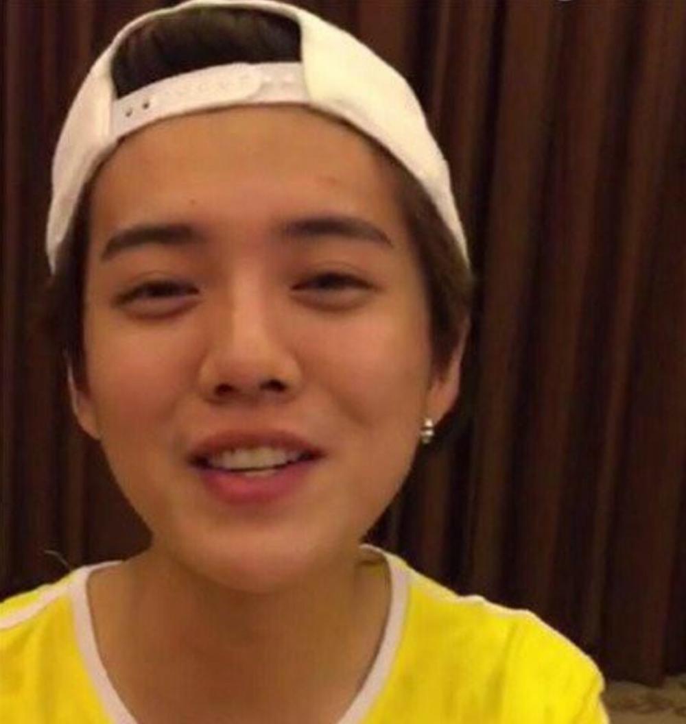 这些明星的黑眼圈都很重,黄子韬的黑眼圈更是