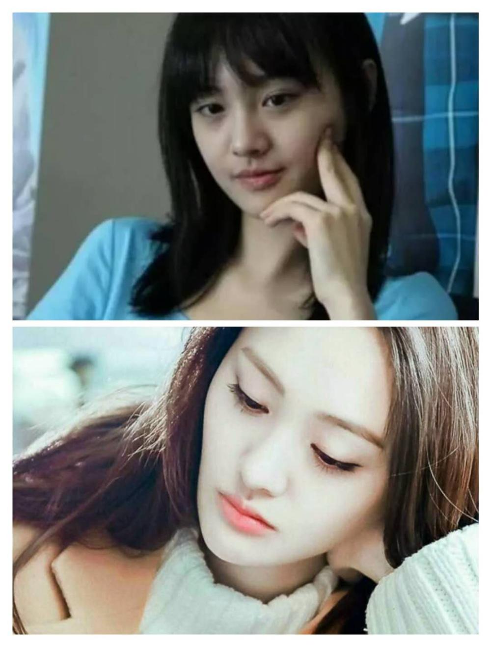 盘点那些整过容的女明星，她们都大方承认了！