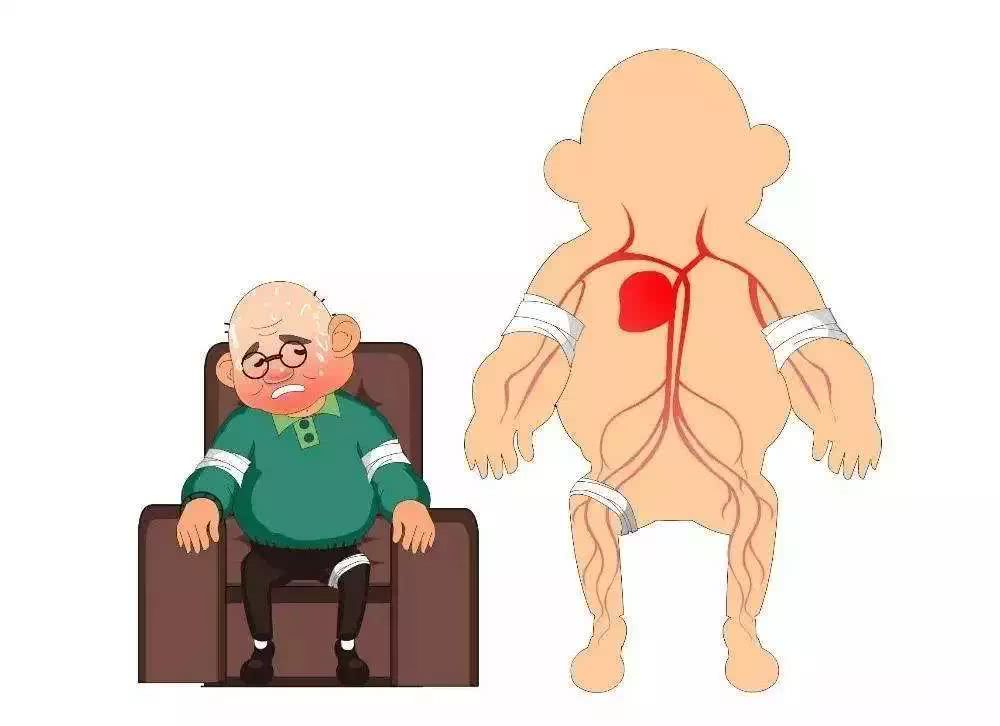 肺心病患者 运动没有统一标准