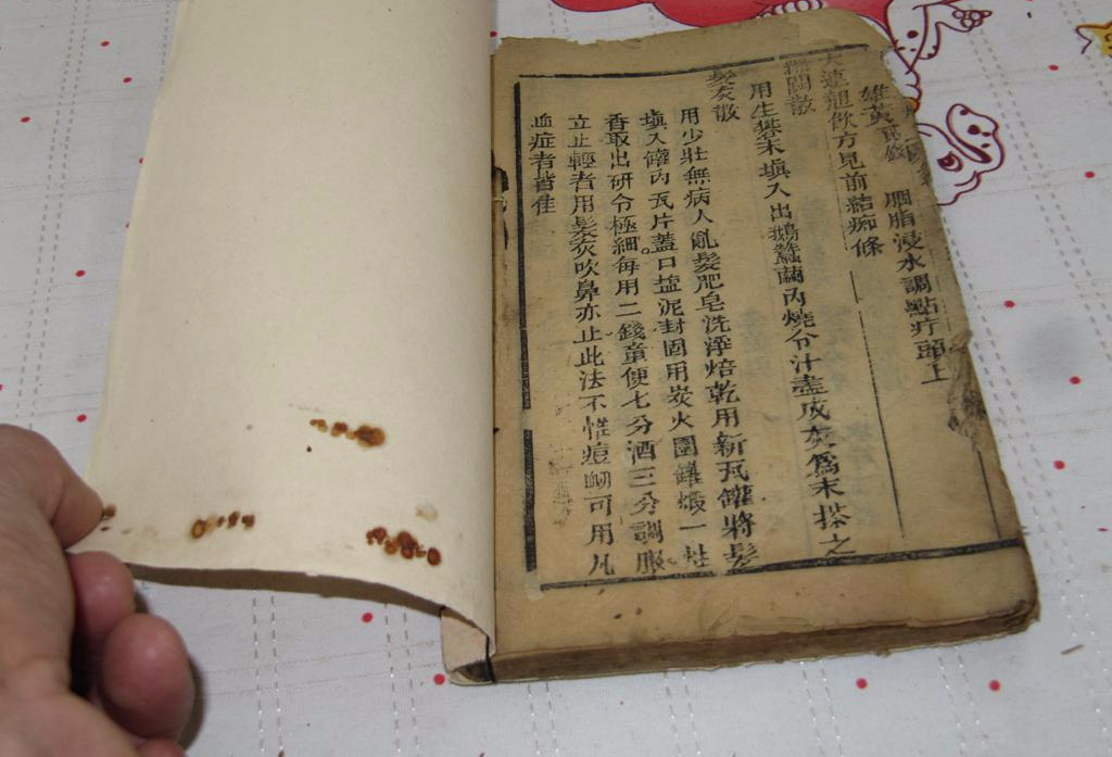 4年痔疮,被此民方根治,1治1个准,3天见效不复发