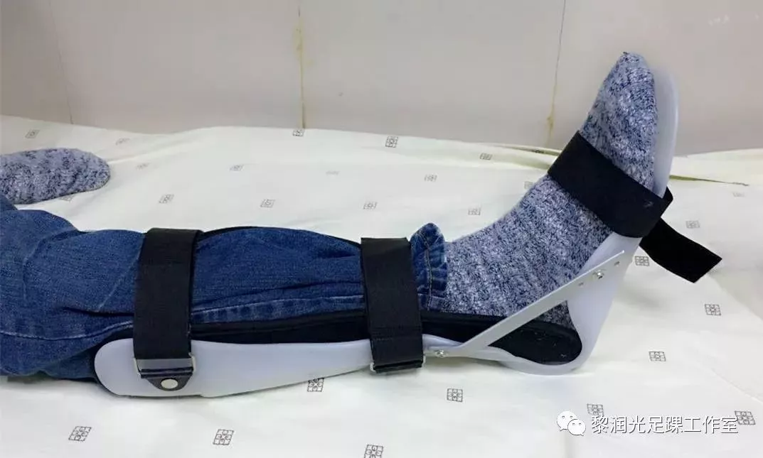 功能支具(可以做踝关节屈曲与背伸活动的支具),限制性支具,石膏固定