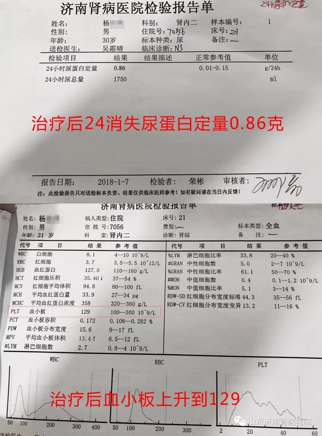 【好消息】经袁群生教授与我院专家组共同会诊救治的危重肾病综合征患