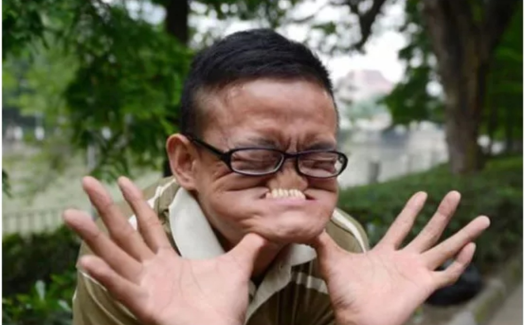 最奇葩吉尼斯世界纪录:世界上最丑的人,还是中国人,特别像首富