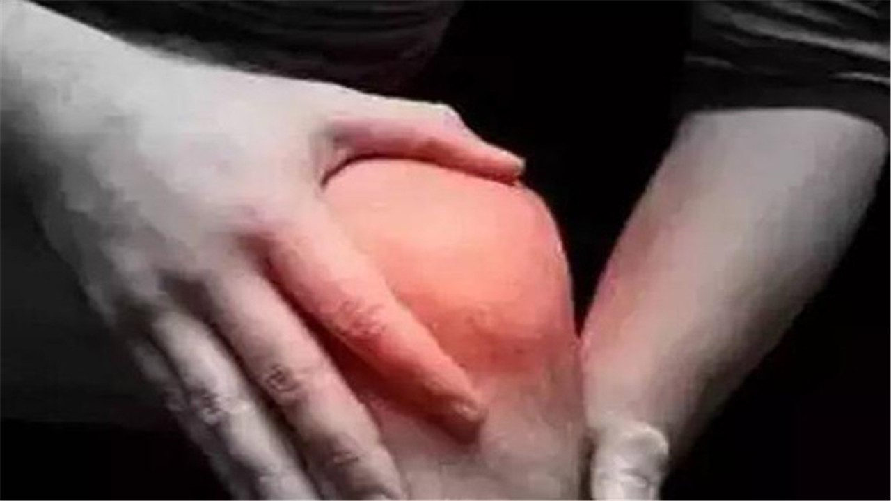 尿酸500，不发作也不痛，可以不管吗?谬论!专家带你分析原因!