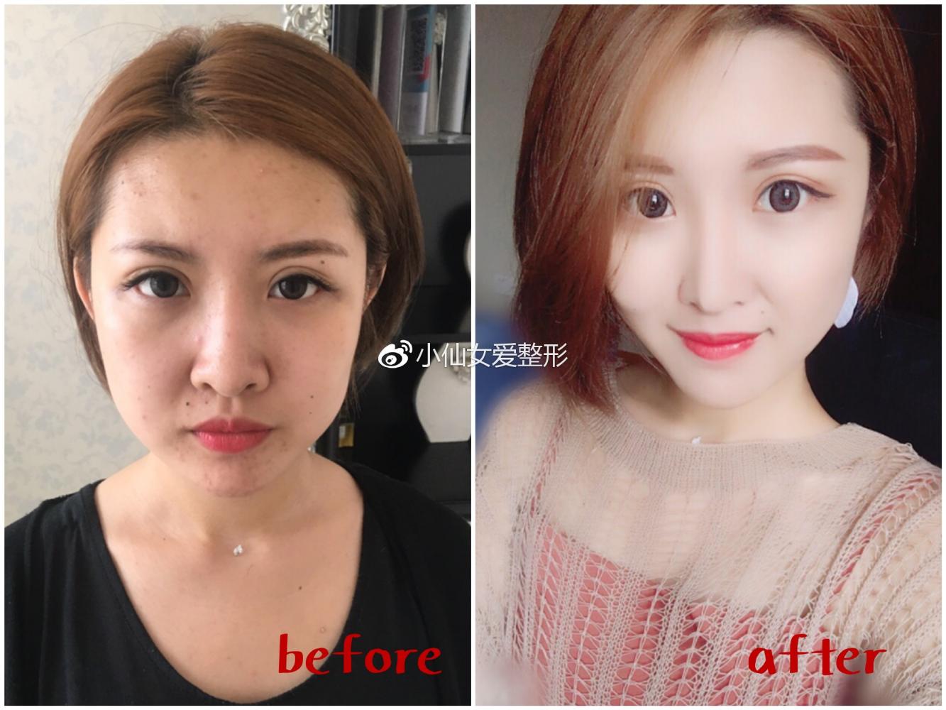 小仙女爱整形问答: get小v脸不用动刀, 脸型精致比脸小更重要