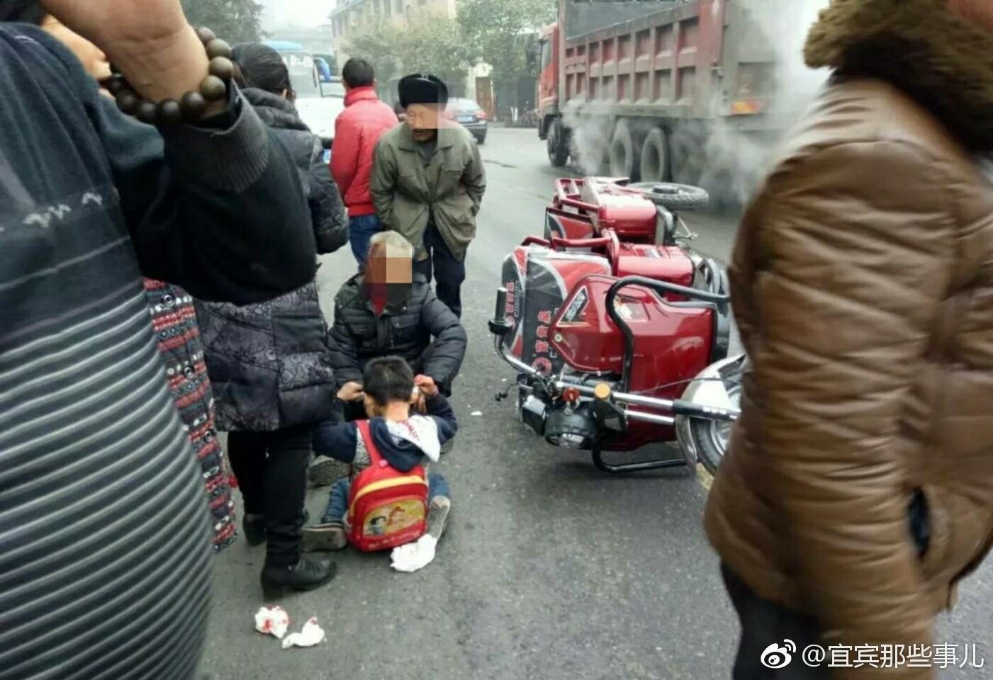 今日下午,宜宾江安二龙口发生车祸,小孩被撞眼睛流血不止!