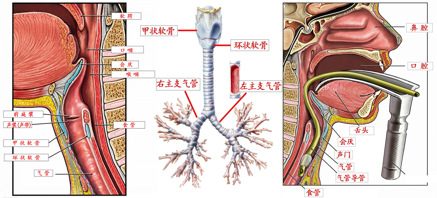 碰到气管异物阻塞怎么办