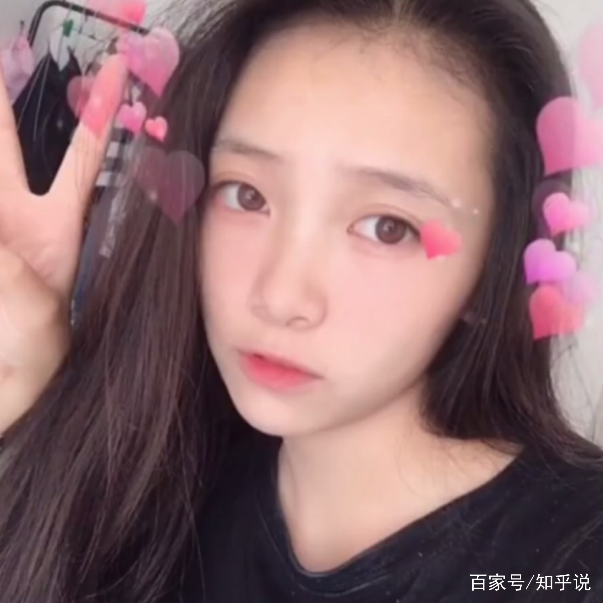 美女姐姐刚毕业就做双眼皮独自分享:美如仙女,看了一眼就