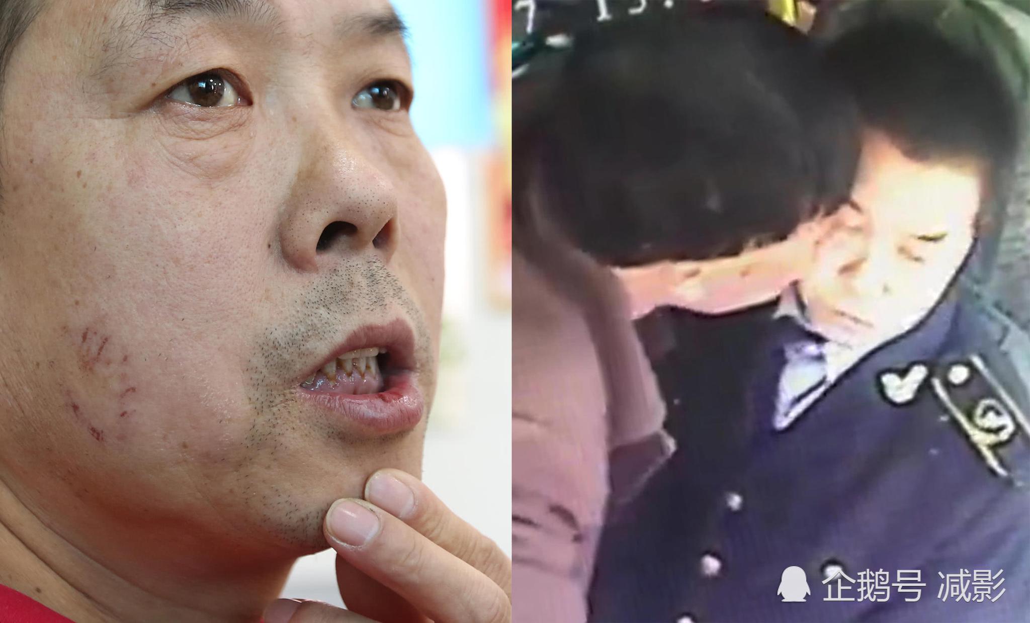 公交司机提醒刷卡 遭醉汉辱骂咬伤打耳光