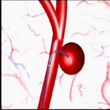 宁波医生 | 拆除人体炸弹,他责无旁贷,换来的是.