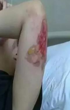 夏天骑电动摩托车，这个故障比自燃更可怕！