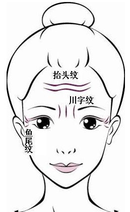面相"悬针纹"代表什么?悬针纹真的"克六亲"吗?