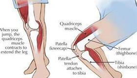 解强医生告诉你:静蹲在膝关节痛治疗中的作用