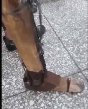 男子自制假腿生活30年, 医院专家见了却这样说……