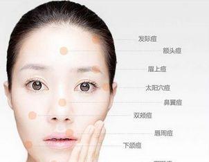 皮肤管理:脸部痘痘和器官反射的关系