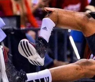 5年最恐怖的受伤,比保罗乔治受伤严重?