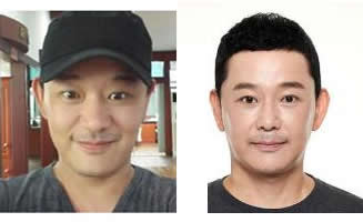 男士面部提升整形 油腻男逆袭之路
