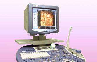 产前诊断超声做三维好还是四维好,好多人想做