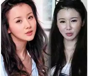 整容最失败的三位女星，越整越糟糕，看着都让人惋惜！