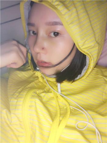 刚做完鼻综合像个猪头,现在这样也算值了-提供