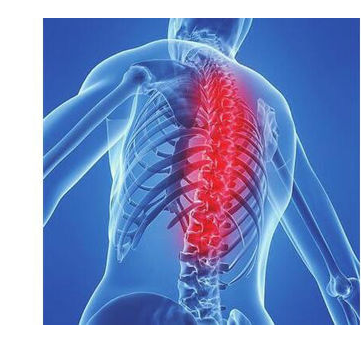 脊髓型颈椎病的保守治疗方法,你知道吗?错过别