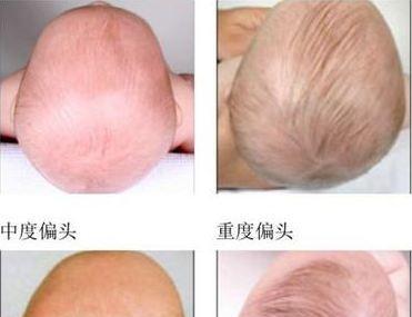 新生儿需要睡平头么?怎么能睡出一个好看的圆头?