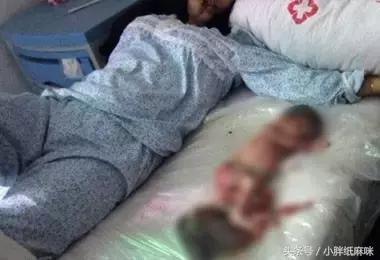 一孕妇怀孕8个月引产