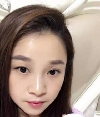 漂亮的女人都在用的大蒜祛斑祛眼袋方法,祛眼