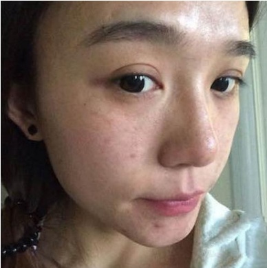 60岁奶奶睡前用金樱子泡酒祛斑？连敷7天，皮肤嫩如婴儿