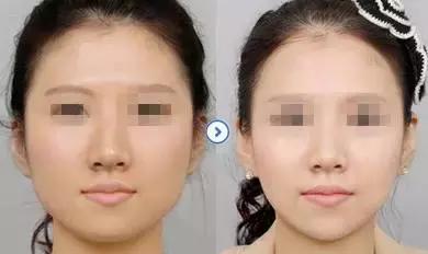 正文   爱 嚼口香糖,啃骨头,吃坚果的妹纸   咬肌都特别发达