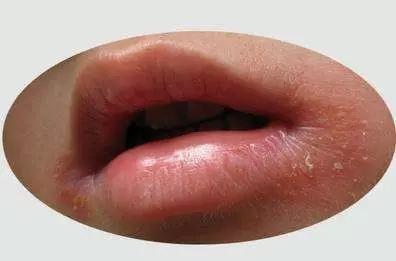 儿童常见口腔疾病有哪些?