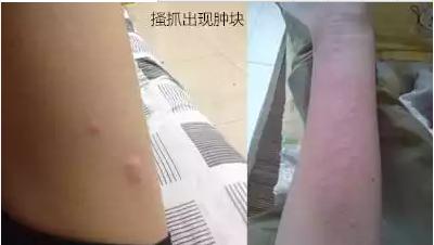 身体这里发痒,竟是癌症拉响了的"警报"