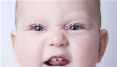 10个月的宝宝,上面两个门牙缝隙大,需要矫正吗