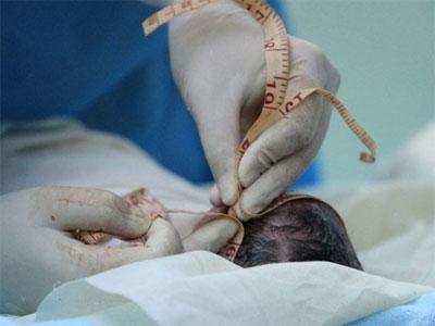 三胞胎分娩全过程真实现场实拍, 生孩子就是这么回事!