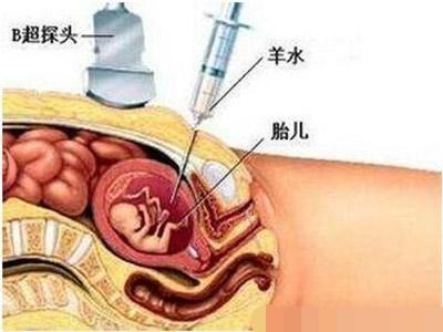 人工流产时胎儿是怎样"打掉"的,看完还敢做吗?请别伤害"它"