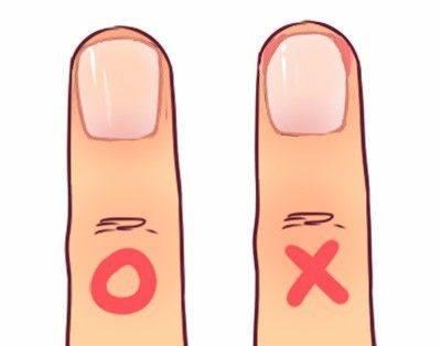 儿子得了甲沟炎, 到医院就把整个指甲拔掉了, 大