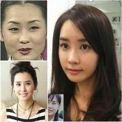 韩国明星整容前后的对比图，权侑莉大变样，tiffany根本认不出