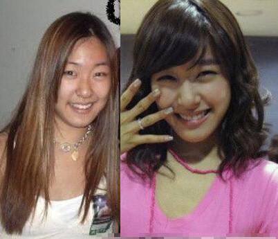 韩国明星整容前后的对比图，权侑莉大变样，tiffany根本认不出