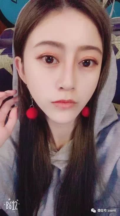 隆鼻前后对比，差别竟然如此大