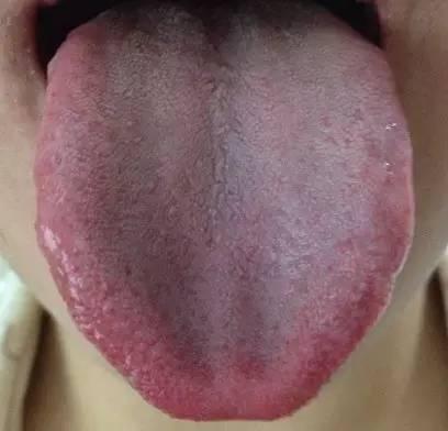 一张图,让你立马分清肾阴虚和肾阳虚的区别!