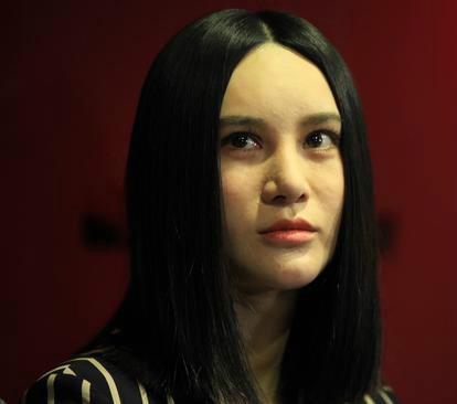 可怕! 那些整容失败的明星现在怎么样了!