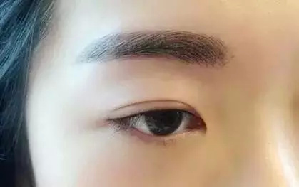 打死都不开眼角，然后我的双眼皮做成了这样~