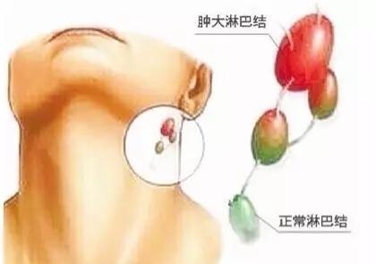 脖子出现很多小疙瘩小斑,说明身体出了状况,应