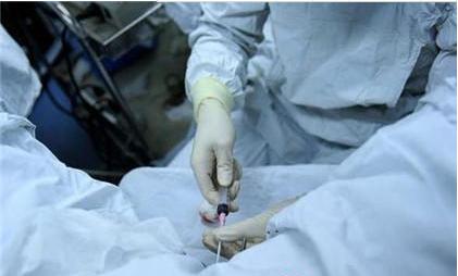 一次做试管婴儿的经历,看着都痛,真的心疼女人