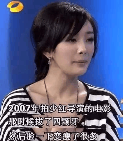 杨幂拔牙瘦身使脸瘦了,拔智齿真瘦脸?火自称冰图片