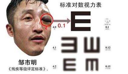 妻子哭诉邹市明被拖欠千万工资,而且视力已达残疾人