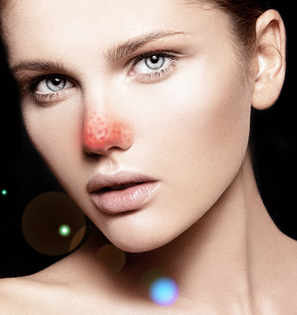 鼻子上一信号也是胃癌征兆,一旦发现快就医,再