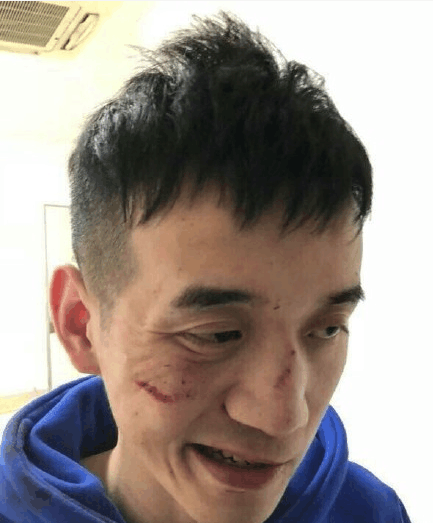 蛋蛋解说回应被打: 不是因为陈同学, 更不是因为