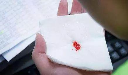 慢性咽炎1年检查出喉癌,医生:真可惜,来的太晚